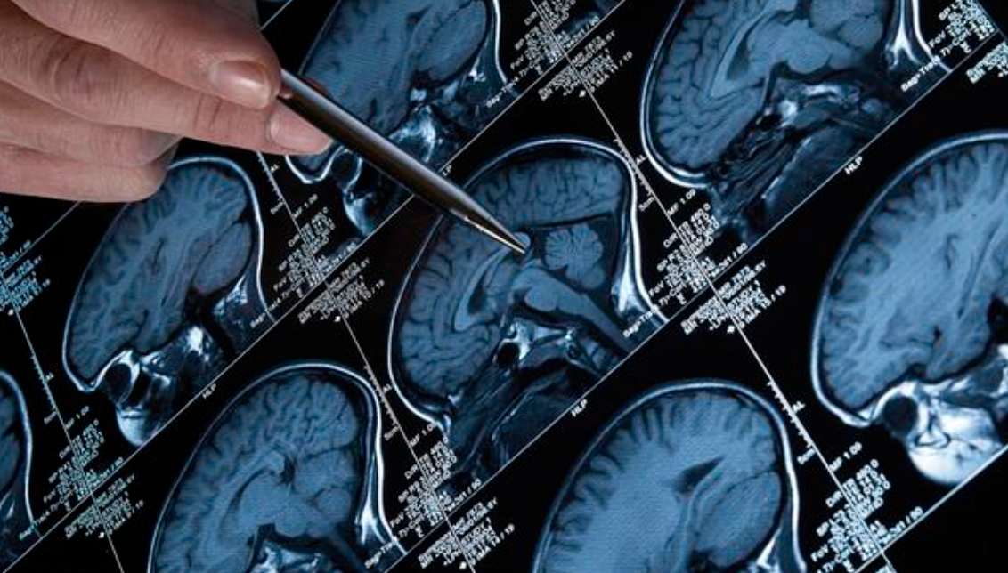 Neurosurgery and spine clinic in Madinaty Cairo